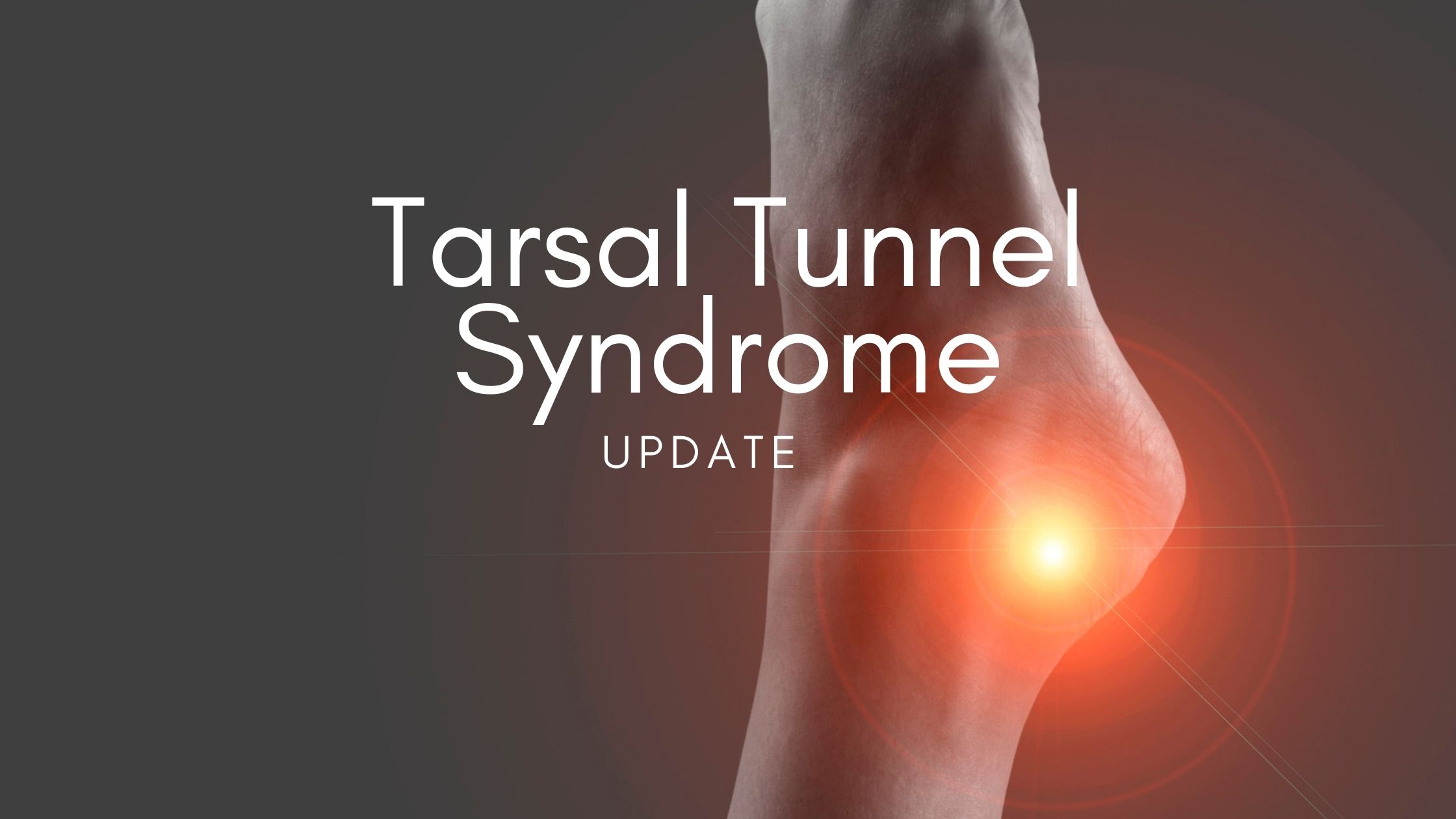 Tarsal Tunnel Syndrome Update